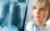 Сучасні принципи та підходи в організації лікування хворих на туберкульоз